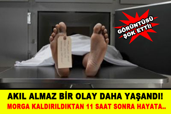 Morga kaldırıldıktan 11 saat sonra hayata geri döndü!