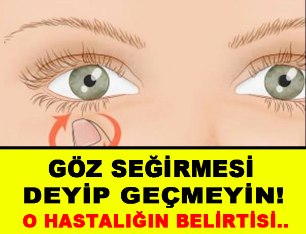 Göz seğirmesi ciddi hastalıkların habercisi olabilir!